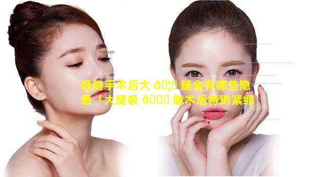 吸脂手术后大 🦍 腿会有哪些隐患「大腿吸 🐛 脂术后特别紧绷是什么原因」